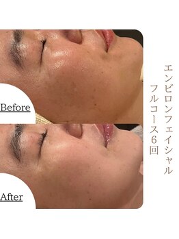 ソワ 恵比寿(soi)/エンビロンフルコース