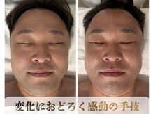 メンズコルギ たるみ改善◎若々しい印象へ！横浜コルギ/横浜小顔