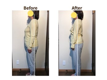 フェルナ(FERNA)/