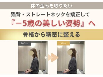 整体クオーレ 奈良新大宮店(Cuore)の写真/どこから見ても美しく。猫背・巻き肩・ストレートネック・反り腰を根本改善して「－5歳の美姿勢」へ