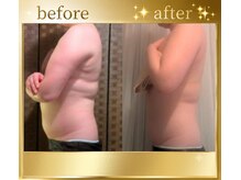ポノ(pono)/WINBACK痩身★BeforeAfter