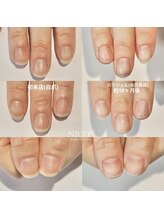 ニコプラス(NICO+)/自爪育成中