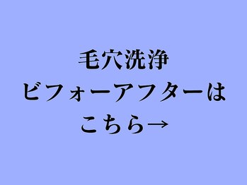 ア クーユ 相模大野店/毛穴洗浄ビフォーアフター♪