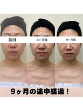 お顔の研究所/ビフォーアフター写真♪