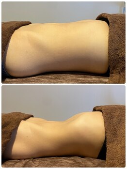 ヨロ(YOLO)/圧倒的変化！YOLO式腸もみ