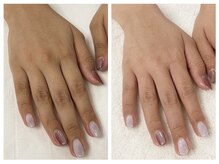 キレイテ 福岡天神店/専門店だからできるくすみケア