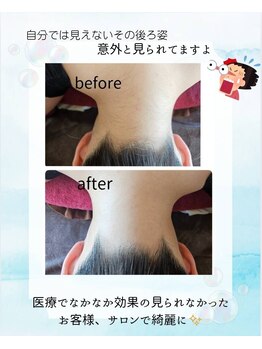 インプルーブ エステティック(Improve ESTHETIC)/