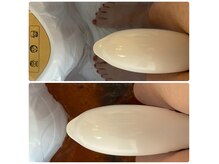 レモン(lemon)の雰囲気（ゴッドクリーナーは体に溜まった不純物などを排出します）