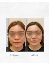 リファイン整体院 国分寺店/小顔、骨盤、ヘッドスパ、整体