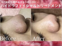 グローバルビューティー 池袋