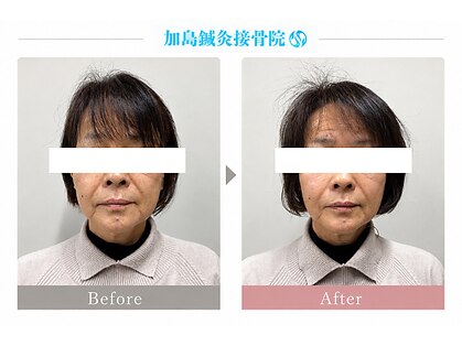 加島鍼灸接骨院の写真