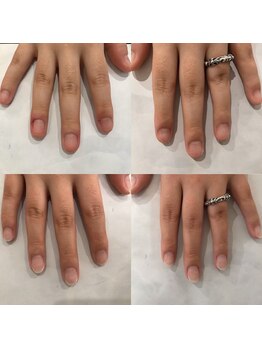 ネイルデコ(nail DECO)/自爪育成3回コース