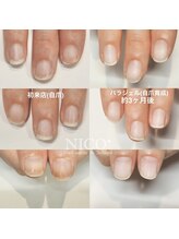 ニコプラス(NICO+)/自爪育成中