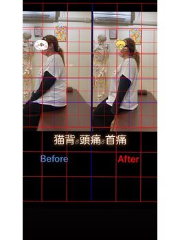 ヒデ整体院(Hide整体院)/猫背・巻き肩改善&骨盤矯正