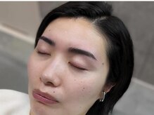 モルフォム(Morphome)/ハリウッドブロウリフト（HBL）