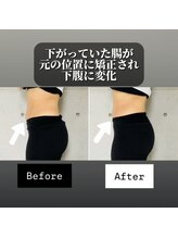 鍼灸整体院ユー(鍼灸整体院You...)/Before/After