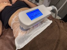 ミセル mozoワンダーシティ店(MYTHEL)/脂肪冷却