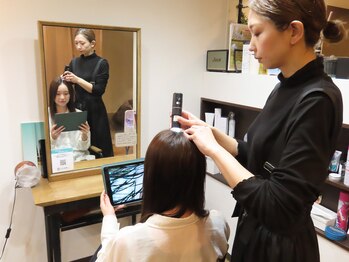 ホープ(HOPE)/頭皮チェック