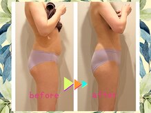 ヨサパーク ハーブ ラキ 鳴海店(YOSA PARK herb *Laki)/緑区ダイエット/痩身/よもぎ蒸し