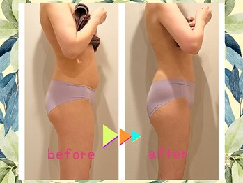 ヨサパーク ハーブ ラキ 鳴海店(YOSA PARK herb *Laki)/緑区ダイエット/痩身/よもぎ蒸し