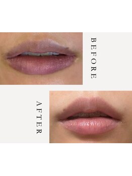 美白ケアをしたい