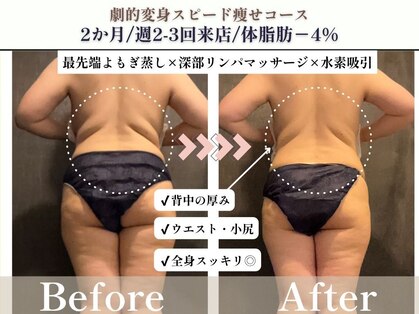 ヨサパーク 杣(YOSA PARK)の写真