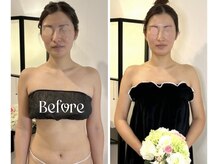 蒼(so)/駆け込みの花嫁様・1回で激変！