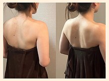 ラフリー 武蔵小杉院(RUFFREE)/肩甲骨のシルエットが劇的改善