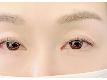 トランジットケイ(TRANSIT K)/左右差も解消。垢抜け目元へ