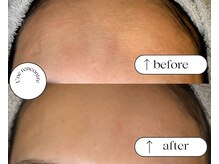 ユヌランコント 岐阜店(Une rencontre)/エンビロン×ラジオ波