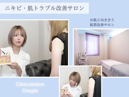 ディンプル(Dimple)の写真