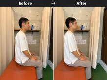 リセット整骨院しぎの院/BeforeAfter
