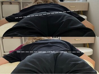 ミノリ(MINORI)/美子宮フェムケア矯正