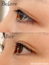 モアナ 逗子 葉山(MOANA)/上下ラッシュリフト