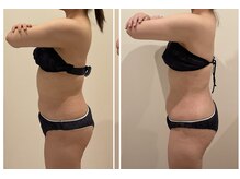 TMサロン 赤坂/首肩スッキリ×全身メンテナンス