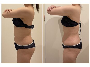 TMサロン 赤坂/首肩スッキリ×全身メンテナンス