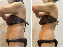 美容整体ウェリナ 中川八田院/小顔矯正/骨盤矯正/痩身整体