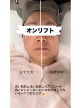 サロン エミリー(Salon Emily)/韓国オンリフト