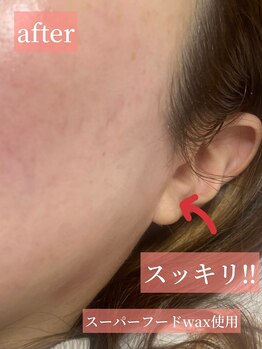 プライベートサロン ヴェール(Veil)/フェイシャルwax