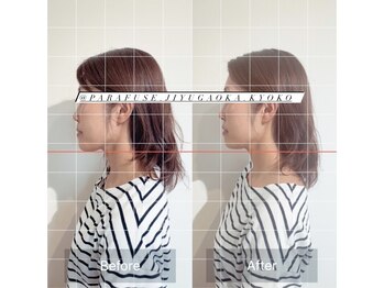 ポノ(pono)/面長改善効果