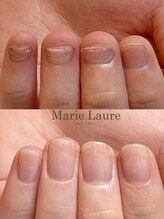 マリーロール 淀屋橋本店(Marie Laure)/自爪育成/深爪矯正/ネイルケア