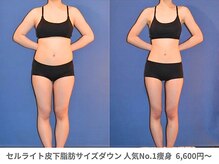 アンシャンテ 神戸元町店(Enchante)/痩身ダイエット　神戸元町三ノ宮