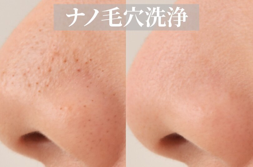 名古屋市で毛穴ケアが人気のエステサロン｜ホットペッパービューティー