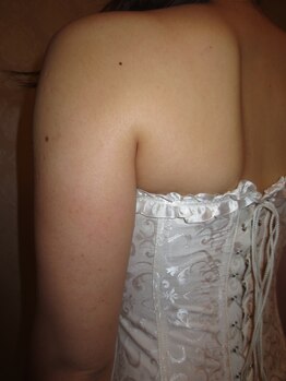 ルメートルセラピー ビューティーサロン(REMETTRE THERAPY)/20代ブライダルエステ成功例