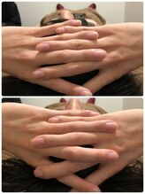 吉川美南ライフ整骨院/30代男性