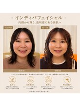 ケイビューティ(k-beauty)/速小顔コルギ/水玉リフティング