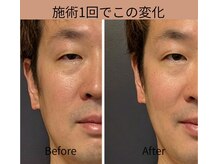 アイセ(AISE)の雰囲気（第一印象もより良く。むくみスッキリ＆眼精疲労改善）