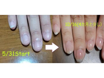 リットネイル(Lit nail)/爪育ネイルケア