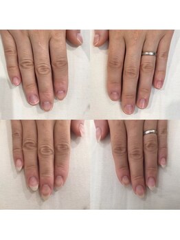 ネイルデコ(nail DECO)/自爪育成3回コース