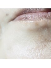 プライベートサロン ヴェール(Veil)/フェイシャルwax